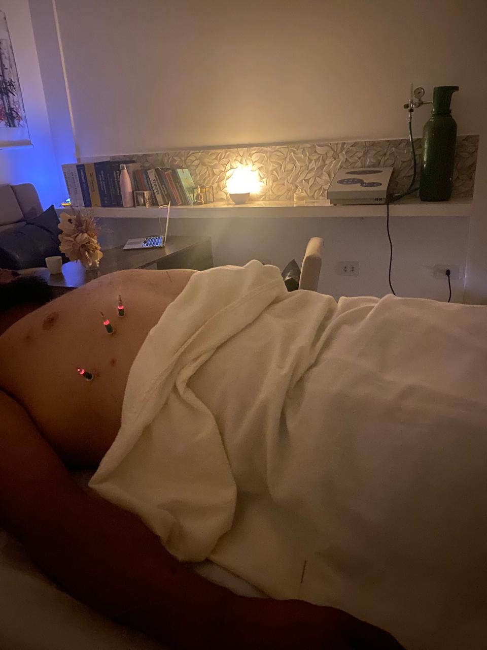 Moxabustão com ventosa e ozonioterapia em Foz do Iguaçu